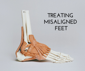 Treating Misaligned Feet